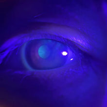 Optometria Iris Checker & Ophthalmology Camera Adapter with LED Light