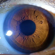 Optometria Iris Checker & Ophthalmology Camera Adapter with LED Light