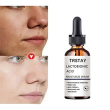 Instant Perfection Face Serum – Lactobionic Acid Anti-Aging Formula